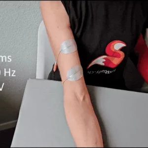 Person erhält Elektrostimulation mit Elektroden am Arm.