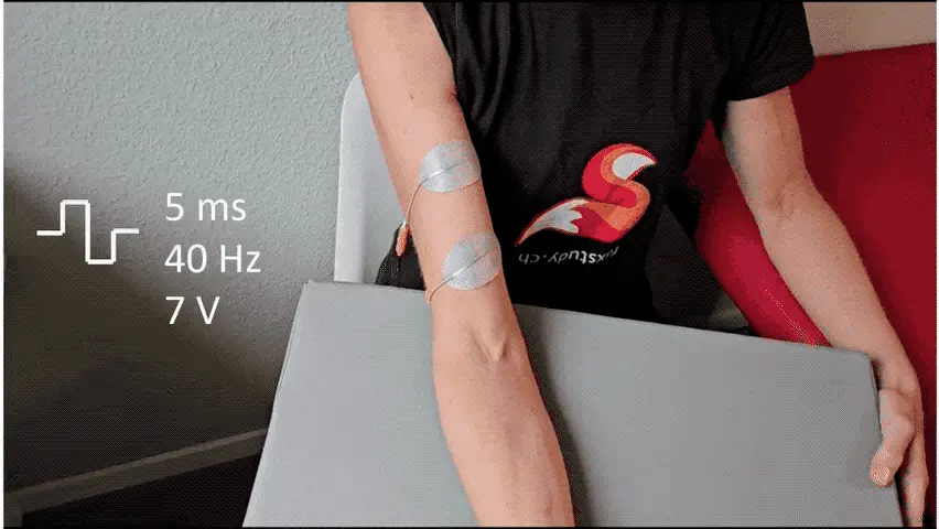 A person receives electrical stimulation via electrodes attached to their arm.
